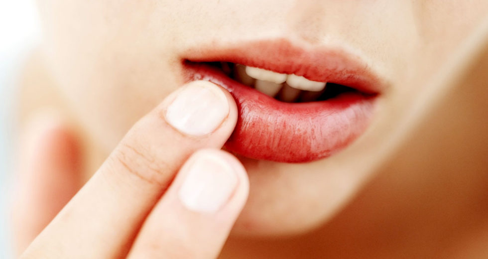 Lábios ressecados: Como evitar e tratar? Veja as melhores dicas!